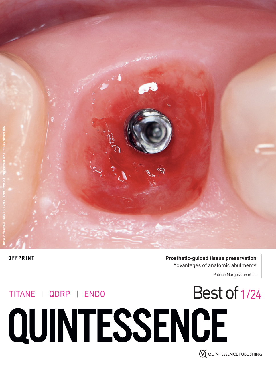 Zrzut ekranu 2026-03-11 o 14.57.21